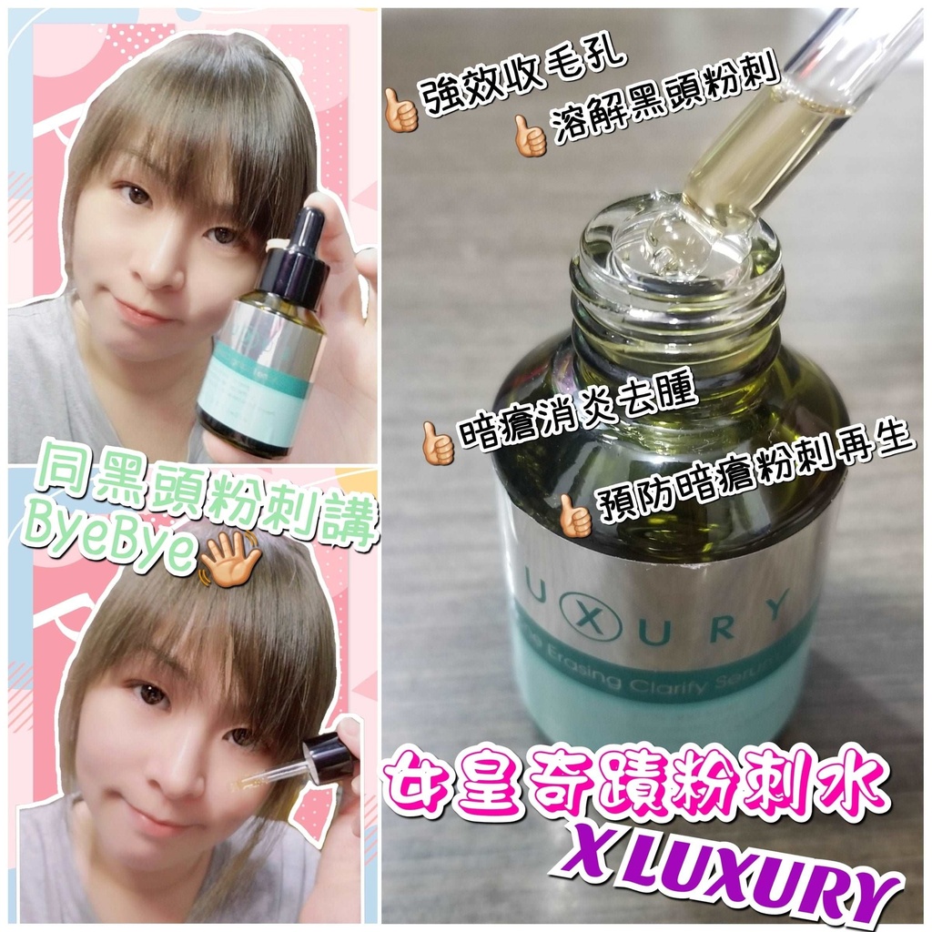 X-Luxury 女皇奇蹟粉刺水 30ml