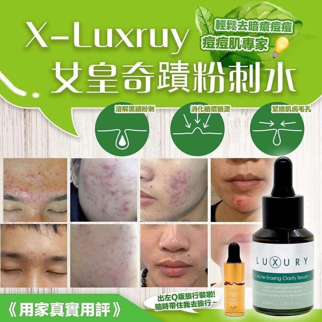 X-Luxury 女皇奇蹟粉刺水 30ml