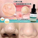 X-Luxury 女皇奇蹟粉刺水 30ml