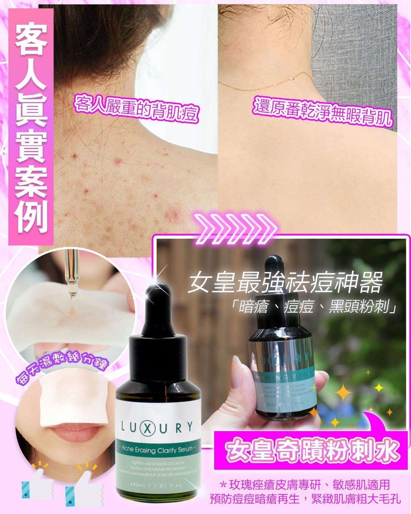 X-Luxury 女皇奇蹟粉刺水 30ml