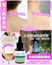 X-Luxury 女皇奇蹟粉刺水 30ml