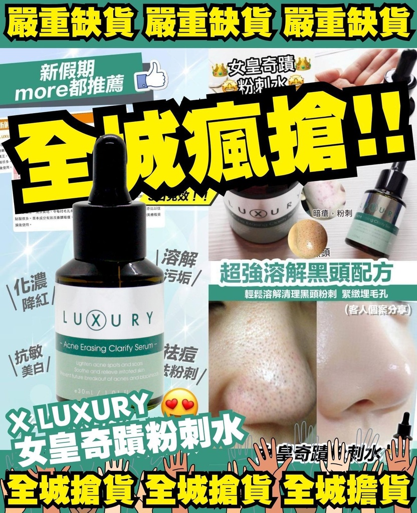 X-Luxury 女皇奇蹟粉刺水 30ml