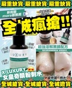 X-Luxury 女皇奇蹟粉刺水 30ml